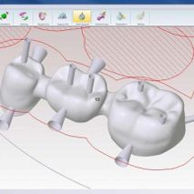 Laboratorio Dental Luan diseño digital de implantes