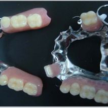 Laboratorio Dental Luan implante de diente