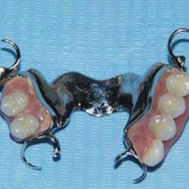 Laboratorio Dental Luan implantes de encía